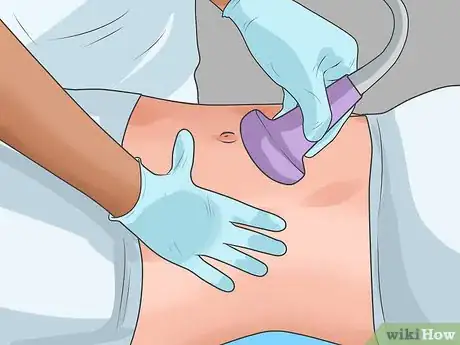 Imagen titulada Cure a Hernia Step 7