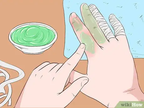 Imagen titulada Use Aloe Vera Step 18