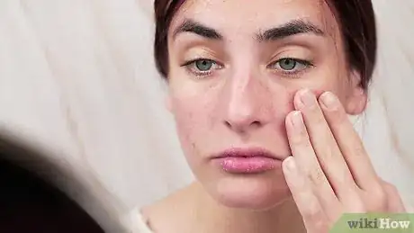 Imagen titulada Remove Blackheads on Your Nose Step 13