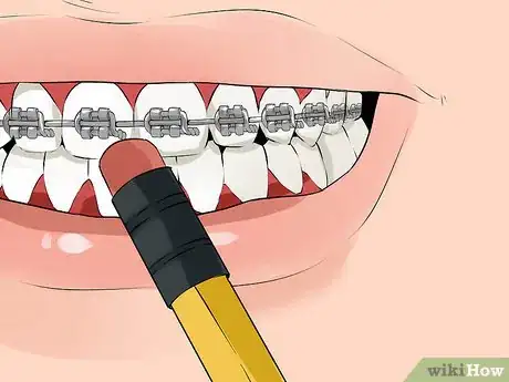 Imagen titulada Fix a Broken Braces Wire Step 5