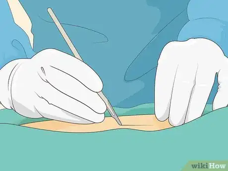 Imagen titulada Untrap a Nerve in Your Lower Back Step 19