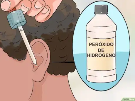 Imagen titulada Treat_a_Fungal_Ear_Infection_Step_9