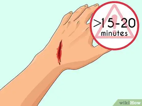 Imagen titulada Make Blood Coagulate Faster Step 4