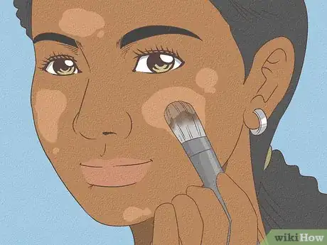 Imagen titulada Stop Dermatillomania Step 11