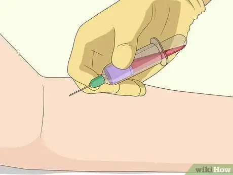 Imagen titulada Treat Liver Fibrosis Step 11