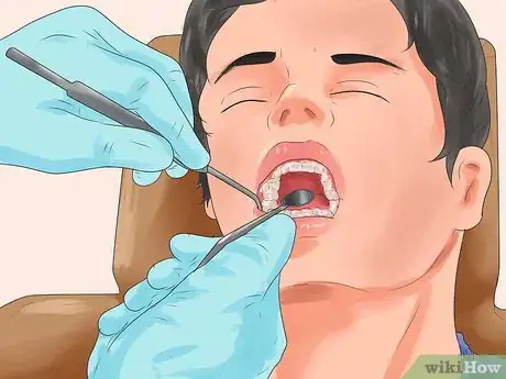 Imagen titulada Get Pink Gums Step 17