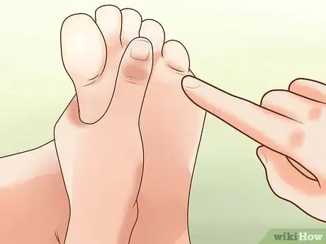 Imagen titulada Prevent Frostbite Step 36