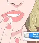 tratar el herpes labial