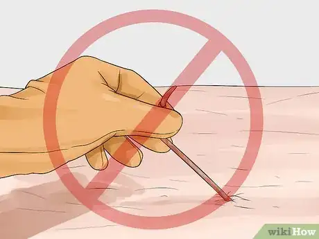 Imagen titulada Find Worms Step 5
