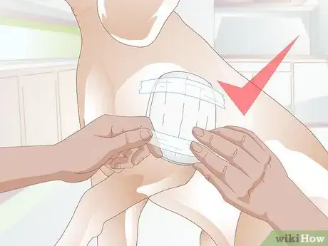 Imagen titulada Treat Benign Fatty Skin Tumors on Dogs Step 7
