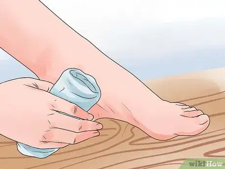 Imagen titulada Care for a Burst Blister Step 2