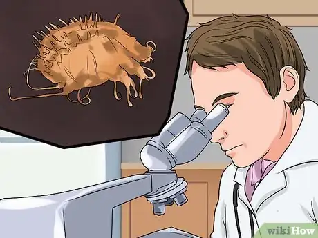 Imagen titulada Diagnose Scabies Step 1