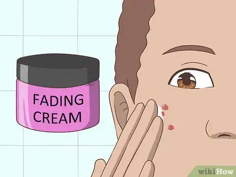 Imagen titulada Get Rid of Acne Cysts Fast Step 19