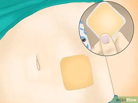 Imagen titulada Use a Contraceptive Patch Step 11
