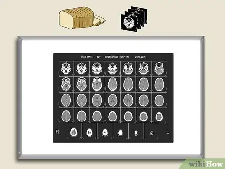 Imagen titulada Read a CT Scan Step 5
