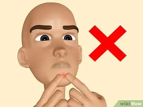 Imagen titulada Make Your Own Acne Treatment Step 13