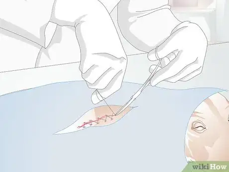 Imagen titulada Treat Benign Fatty Skin Tumors on Dogs Step 6