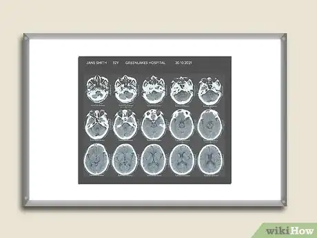 Imagen titulada Read a CT Scan Step 2