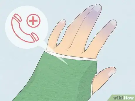 Imagen titulada Cope With a Broken Wrist Step 11