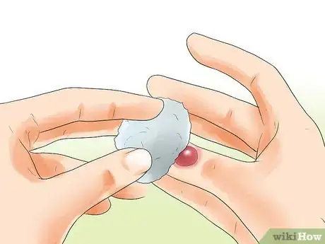 Imagen titulada Make a Huge Blister Heal Step 4
