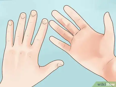 Imagen titulada Prevent Frostbite Step 30