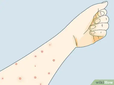Imagen titulada Prevent Flea Bites Step 19