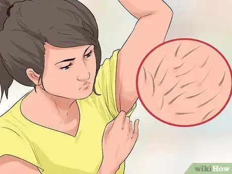 Imagen titulada Fake Your Period Step 10