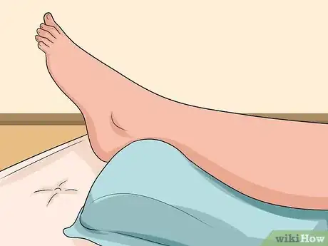 Imagen titulada Know if You've Sprained Your Ankle Step 11