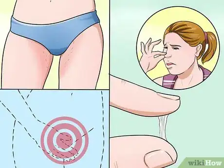 Imagen titulada Stop Vaginal Itching Step 10