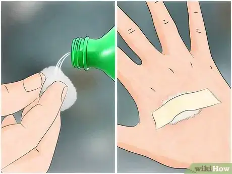 Imagen titulada Reduce the Pain of Gnat Bites Step 2