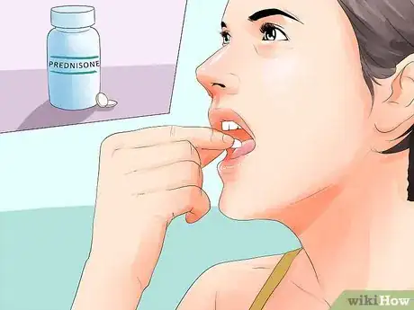 Imagen titulada Cure Bell's Palsy Facial Nerve Disorders Step 2