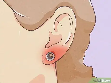 Imagen titulada Gauge Your Ears Step 15