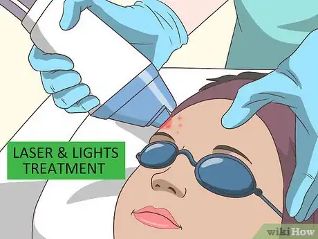 Imagen titulada Get Clear, Smooth Skin Step 18
