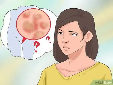 Imagen titulada Prevent the Spread of Genital Warts Step 1