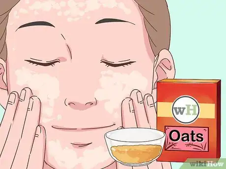 Imagen titulada Avoid Irritation when Exfoliating Skin Step 4