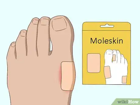 Imagen titulada Stop a Bunion from Growing Step 7