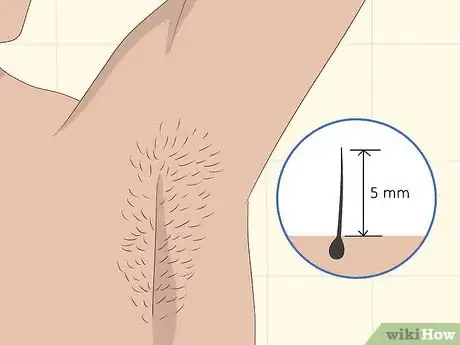 Imagen titulada Remove Armpit Hair Step 25