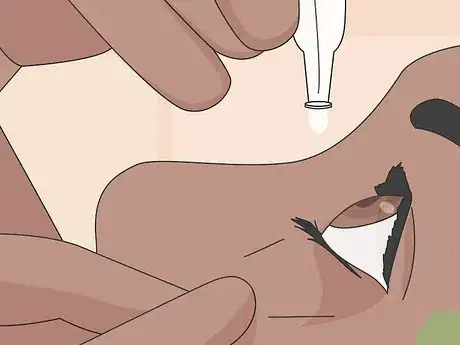 Imagen titulada Deal With Uncomfortable Contact Lenses Step 12