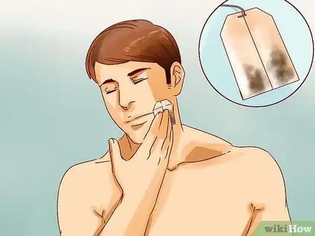 Imagen titulada Get Rid of a Deep Pimple Step 11