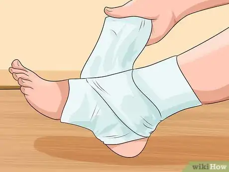 Imagen titulada Know if You've Sprained Your Ankle Step 13