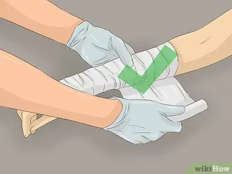 Imagen titulada Treat a Rattlesnake Bite Step 8