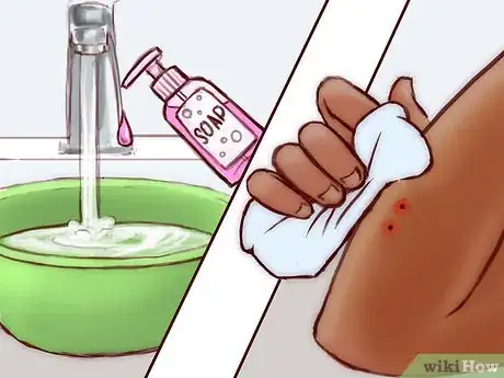 Imagen titulada Treat a Snake Bite Step 10