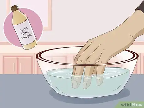 Imagen titulada Make Your Fingers Hard for Guitar Step 8.jpeg