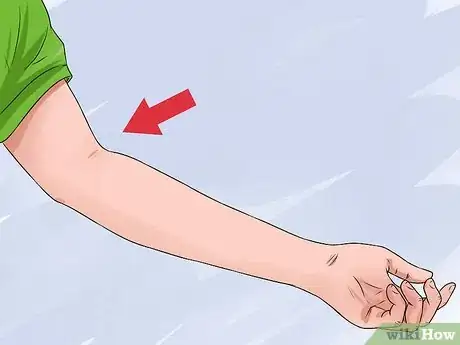 Imagen titulada Properly Place a TB Skin Test Step 9