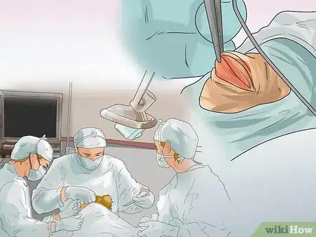 Imagen titulada Treat Eye Problems in Pugs Step 8