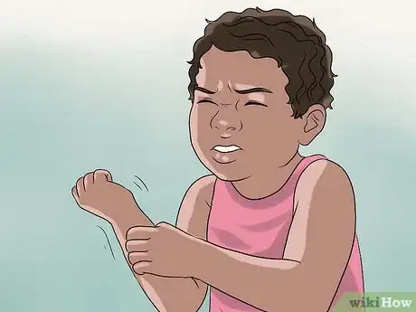 Imagen titulada Diagnose Scabies Step 3