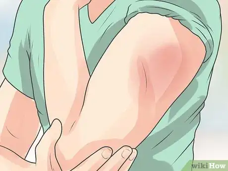 Imagen titulada Manage a Painful Injection Step 9