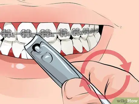 Imagen titulada Fix a Broken Braces Wire Step 6