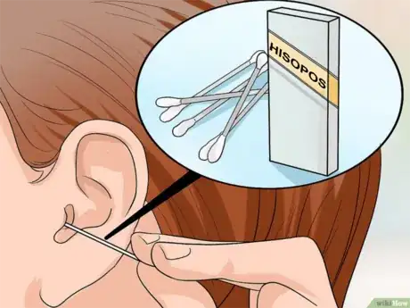 Imagen titulada Treat_a_Fungal_Ear_Infection_Step_3