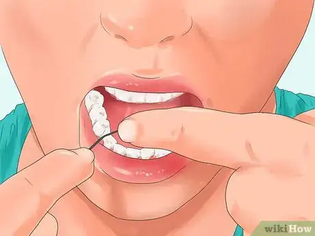 Imagen titulada Get Pink Gums Step 10